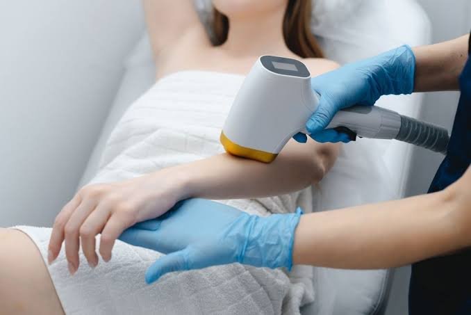 Laser hair removal at Skin Bliss