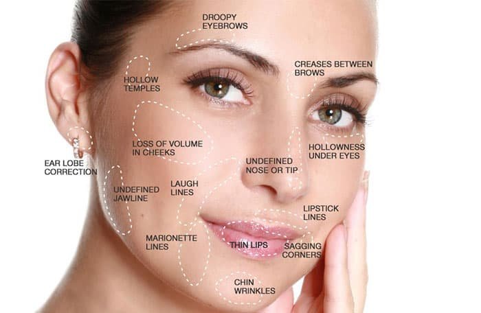 Dermal fillers treatment at Skin Bliss