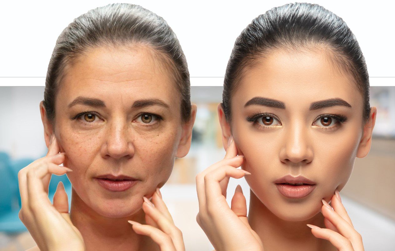 Botox treatment at Skin Bliss