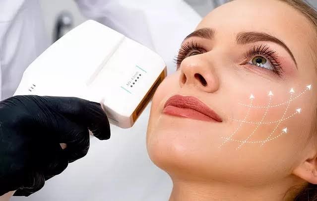 HIFU facelift treatment at Skin Bliss
