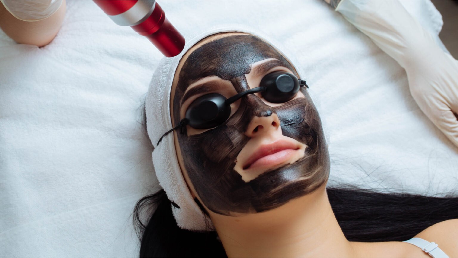 Carbon peel laser at Skin Bliss