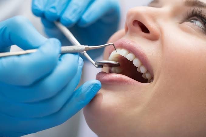 Dental check-up at Skin Bliss Karachi